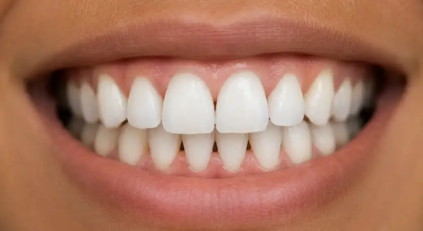 Triángulos negros entre los dientes