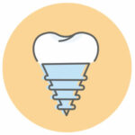 Implantes dentales en Mataró y Barcelona