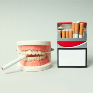 Impacto del consumo de tabaco en la dentadura.